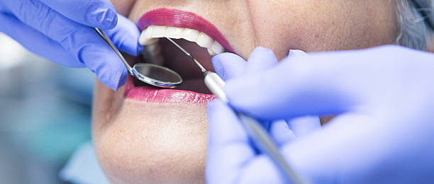 Best Emergency Wisdom Teeth Removal in Angustura, NM
