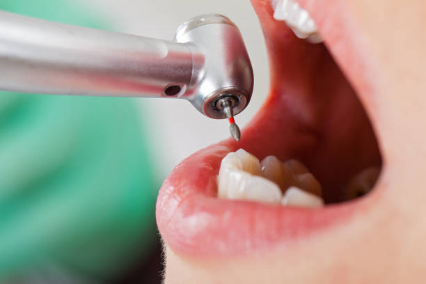 Best Emergency Dental Care for Trauma or Injury in Angustura, NM